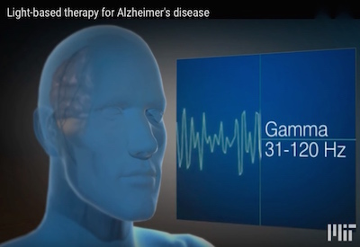 LED Stimulation: A New Treatment For Alzheimer’s?